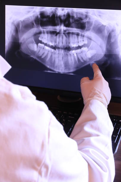 Best Emergency Tooth Extraction in Eureka, CA